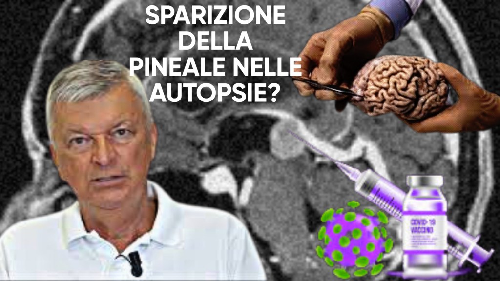 I sieri e la distruzione della pineale – Cosa ne pensa Stefano Montanari?